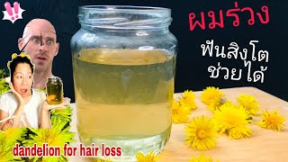 รักษาผมร่วงด้วยชาแดนดิไลออน (ต้นฟันสิงโต) | dandelion tea for hair loss | kkdกีกี้เดฟ