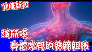 【健康新知】淺筋膜：身體常見的結締組織