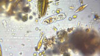 Amoeba ( species: Saccamoeba ).avi