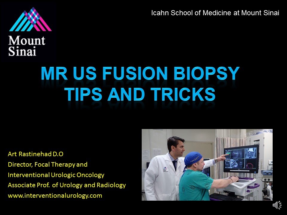 6 UroNav TIPS AND TRICKS Rastinehad Fusion Biopsy Youtube Video - YouTube