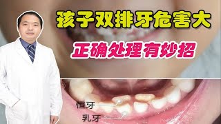 孩子双排牙怎么办