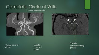 Circle of Willis