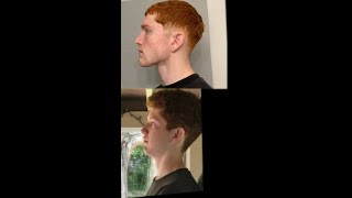 Does Mewing Work? (3 year transformation)