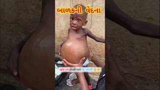 બાળકની વેદના 😱 આ છોકરા નું પેટ ફૂલવા લાગ્યું #shortvideo #facts