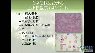 瀬戸口明日香先生の「明日から役立つ」シリーズ「症状や所見から鑑別診断リストを作成する」第８回　トピック12 ： 血小板減少症へのアプローチ