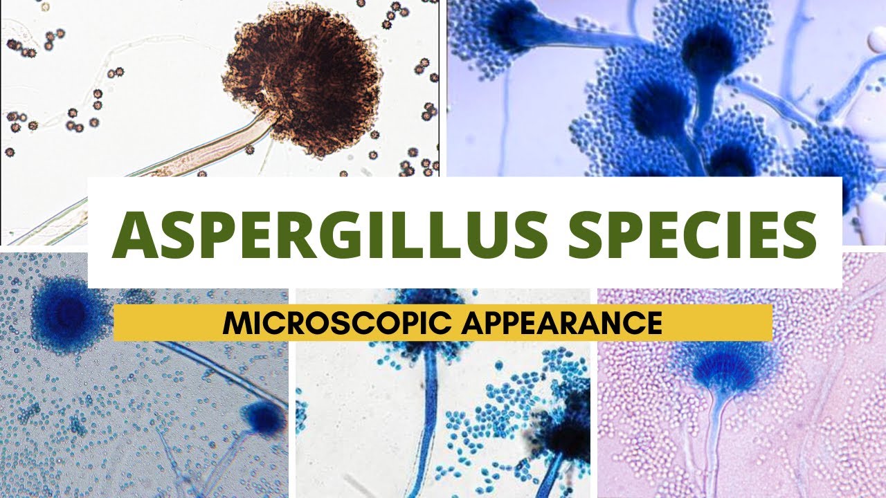 Aspergillus Niger Structure