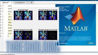 Image Processing In MATLAB | Thresholding | Binarization