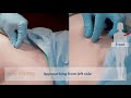 5. needle decompression tns trauma procedure video series