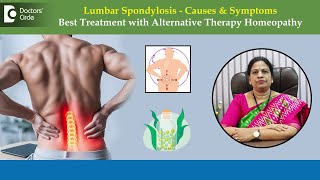 How to Treat Lumbar Spondylosis with Alternative Medicine Homeopathy-DrBhagyalakshmi|Doctors' Circle