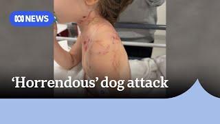 Little girl recovering after 'horrendous' dog attack south of Perth | ABC News