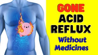 5 Natural Ways to Stop ACID REFLUX: How to Stop HEARTBURN Without Medication