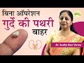 Kidney stone treatment without surgery | किडनी स्टोन का घरेलू इलाज | पथरी कैसे निकाले | Aayu Shakti