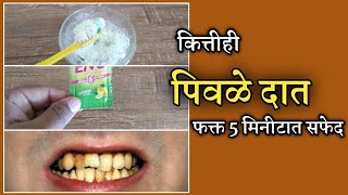 पिवळे-काळे दात 5 मिनिटात मोत्यांसारखे सफेद; करा हा उपाय। suprefast teeth whitening home remedy