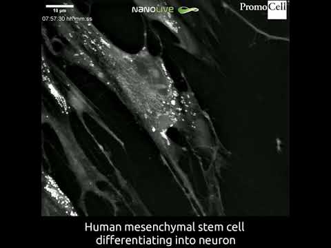 Cells in action Differentiation of human mesenchymal stem cells from the umbilical cord matrix into neurons