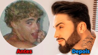 Como Ficar + BONITO Rosto MASCULINO, TOP 5 Procedimentos de Beleza Masculinos