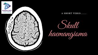 Skull haemangioma, Skull lesions #Umamaheshwar Reddy.V