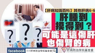 【肝病知識百科】其他肝病6-6肝囊腫