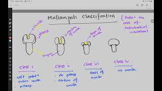 Mallampati Classification