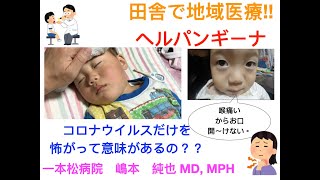 子供の発熱対応　〜総合医の子供が高熱になったらどう対応する？〜 #子供 #総合診療 #地域医療 #発熱 #ヘルパンギーナ