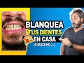 🤔 Si quieres saber como BLANQUEAR tus dientes AMARILLOS en 🏠 CASA  ESTE REMEDIO no tiene DESPERDICIO