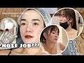 GOT MY NOSE JOB IN TAIWAN .. FINALLY !!! | ERIKA RAMOS