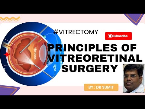 Principles Of Vitreoretinal Surgery And It's Procedure...... - YouTube