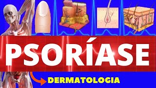 PSORÍASE - CAUSAS, SINTOMAS E TRATAMENTO - CARACTERÍSTICAS DA PSORÍASE - DERMATOLOGIA