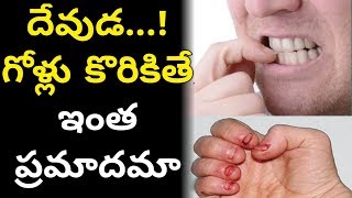 గోళ్లు కొరికితే ఇంత ప్రమాదమో తెలిస్తే జీవితంలో మళ్లి గోర్లు కొరకరు || Nails bitting problems