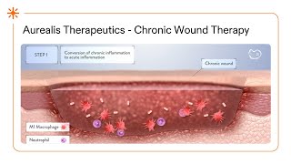 Chronic Wound Treatment: AUP-16 by Aurealis Therapeutics