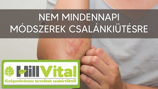 7 meglepő módszer csalánkiütés ellen - HillVital