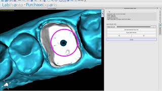 Design and Mill Conventional Crowns (XML File Included) - BSP 4.7.5