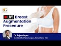 [LIVE] Breast Augmentation Procedure | Dr Rajat Gupta, Plastic Surgeon, RG Aesthetics