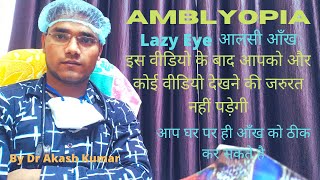 amblyopia ! lazy eye ! lazy eye in hindi ! how to fix lazy eye ! lazy eye exercise treatment