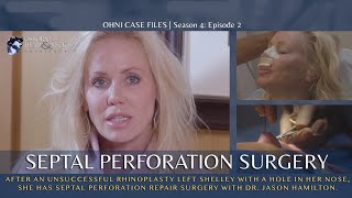 Nurse Practitioner has Septal Perforation Repair Surgery