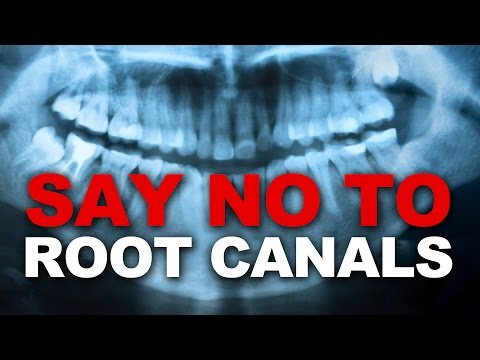 Say NO to Root Canals - Damaging to your Health Say NO to Root Canals - Damaging to your Health