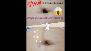 รีวิวพรีชีพ ขัดขี้ไคลสะดือแม่หลังคลอดหลุดแบบชิวๆ