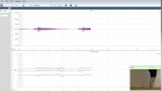 リハビリ,運動時の下肢筋活動を無線筋電システム「Cometa」で計測