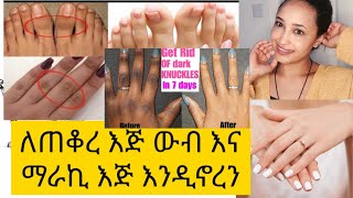 በ ሶስት ቀን ለጠቆረ እጅ ሁነኛ መላ 👌👌👌