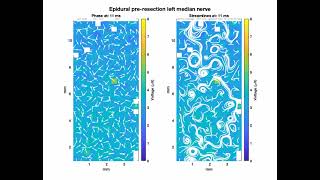 A microelectrode array that provides precise 2D maps of spinal cord electrophysiology during surgery