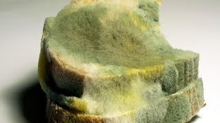 Mold & Allergies (Conditions A-Z)