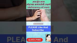 आवर्जून वाचा लोहाच्या कमतरतेची लक्षणे(deficiency of iron)#shortvideo #healthtips #viral #marathi