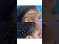 get your edges back the best hair doctor hairgrowth hairlossttreatment