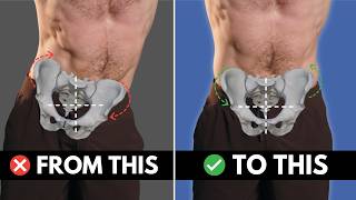 The Game-Changing Method To FIX Uneven Hips (Lateral Pelvic Tilt)