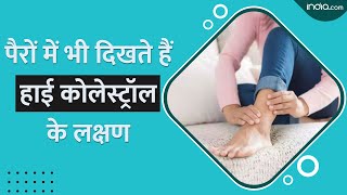 High Cholesterol: पैरों में दिखते ये लक्षण हैं बढ़ते कोलेस्ट्रॉल की निशानी, वीडियो में जानें डिटेल्स