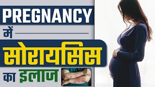 Pregnancy में सोरायसिस का इलाज | Pregnancy With Psoriasis | Dr Health | Dr Megha Chaturvedi