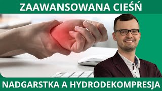 Zabieg hydrodekompresji w leczeniu zaawansowanego stopnia cieśni nadgarstka - lek. Tomasz Grądzki