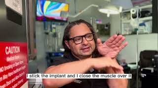BBL vs Butt Implants with Plastic surgeon Dr. Jeneby