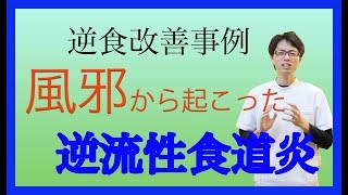 【逆流性食道炎改善例】20代男性 風邪が原因の逆食