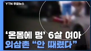 '온몸에 멍 자국' 6살 여아 숨져...함께 살던 외삼촌 \