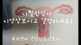 나팔관 검사 이영상 보고 결정하세요 @ramirami_iui_ivf